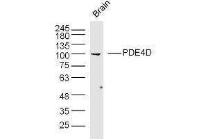 Mouse brain lysates probed with PDE4D Polyclonal Antibody, unconjugated  at 1:300 overnight at 4°C followed by a conjugated secondary antibody at 1:10000 for 90 minutes at 37°C. (PDE4D Antikörper  (AA 401-550))