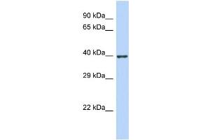 Host:  Rabbit  Target Name:  ZNF607  Sample Type:  Jurkat Whole Cell lysates  Antibody Dilution:  1. (ZNF607 Antikörper  (N-Term))