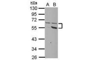 Image no. 1 for anti-Plexin Domain Containing 2 (PLXDC2) (AA 1-218) antibody (ABIN1500293) (PLXDC2 Antikörper  (AA 1-218))