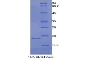 SDS-PAGE analysis of Mouse CEA Protein. (CEA Protein)