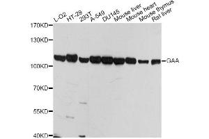 Western blot analysis of extracts of various cell lines, using GAA antibody (ABIN5974462) at 1/1000 dilution. (GAA Antikörper)