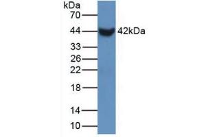 Figure. (SFTPB Antikörper  (AA 20-193))