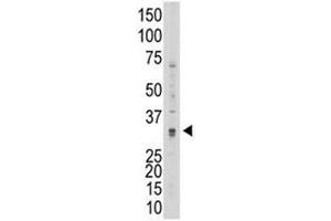 Western Blotting (WB) image for anti-Matrix Metallopeptidase 7 (Matrilysin, Uterine) (MMP7) (AA 117-146) antibody (ABIN3031723)