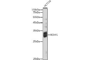 Western Blotting (WB) image for anti-Ring Finger and CHY Zinc Finger Domain Containing 1, E3 Ubiquitin Protein Ligase (RCHY1) antibody (ABIN7270050)
