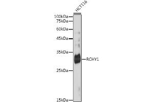 Western blot analysis of extracts of HCT116 cells, using RCHY1 antibody (ABIN7270050) at 1:1000 dilution. (RCHY1 Antikörper)
