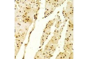 Immunohistochemistry of paraffin-embedded Human esophageal using MSH2 antibody at dilution of 1:100 (x400 lens). (MSH2 Antikörper  (AA 1-300))