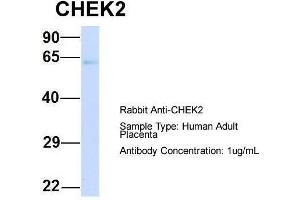 Host:  Rabbit  Target Name:  CHEK2  Sample Type:  Human Adult Placenta  Antibody Dilution:  1. (CHEK2 Antikörper  (N-Term))
