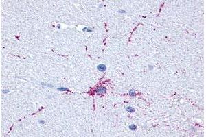 Immunohistochemical (Formalin/PFA-fixed paraffin-embedded sections) staining in human brain, neurons and glia with GRM8 polyclonal antibody . (GRM8 Antikörper  (C-Term))