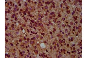 IHC image of ABIN7154699 diluted at 1:500 and staining in paraffin-embedded human glioma performed on a Leica BondTM system. (GNAL Antikörper  (AA 4-116))