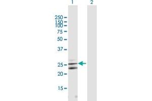 Western Blot analysis of CLCF1 expression in transfected 293T cell line by CLCF1 MaxPab polyclonal antibody. (CLCF1 Antikörper  (AA 1-225))