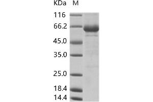 Western Blotting (WB) image for Coxsackie Virus A16 VP1 (Cox A16 VP1) protein (Fc Tag) (ABIN7198887) (Cox A16 VP1 Protein (Fc Tag))