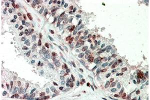 Immunohistochemistry (5μg/ml) staining of paraffin embedded Human Prostate. (ZIC3 Antikörper  (Internal Region))