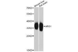 Western blot analysis of extracts of various cell lines, using ARG1 Antibody. (Liver Arginase Antikörper  (AA 1-322))