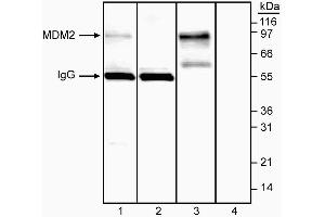 Immunoprecipitation/western blot analysis of MDM2. (MDM2 Antikörper  (AA 154-167))