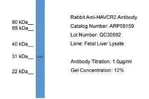 WB Suggested Anti-HAVCR2  Antibody Titration: 0. (TIM3 Antikörper  (C-Term))