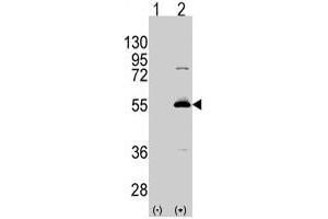 Western blot analysis of ALDH6A1 (arrow) using rabbit ALDH6A1 polyclonal antibody . (ALDH6A1 Antikörper  (C-Term))