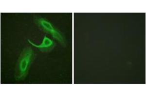 Immunofluorescence analysis of HeLa cells, using CD18/ITGB2 (Ab-758) Antibody.