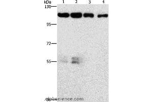 Western blot analysis of Hela and hepG2 cell, lovo cell and human colon cancer tissue, using CDK11A/CDK11B Polyclonal Antibody at dilution of 1:750 (CDK11 Antikörper)