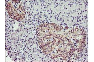 Immunohistochemical staining of paraffin-embedded Human pancreas tissue using anti-TMOD1 mouse monoclonal antibody.