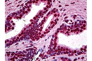 Anti-MEF2A antibody IHC of human prostate. (MEF2A Antikörper  (AA 71-170))
