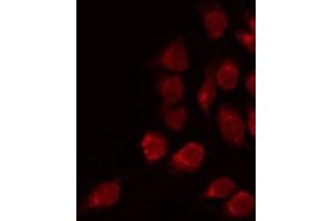 ABIN6275382 staining COLO205 by IF/ICC. (Kcng2 Antikörper  (Internal Region))
