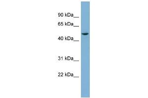 WB Suggested Anti-TUBE1 Antibody Titration: 0. (TUBE1 Antikörper  (Middle Region))