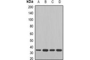 Western blot analysis of MDH2 expression in Jurkat (A), A549 (B), mouse liver (C), mouse heart (D) whole cell lysates. (MDH2 Antikörper)