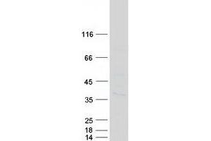Validation with Western Blot