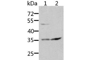 Western Blot analysis of HT-29 and 231 cell using SOCS1 Polyclonal Antibody at dilution of 1:1700 (SOCS1 Antikörper)