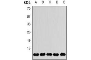 Western blot analysis of FKBP2 expression in MCF7 (A), SKOV3 (B), Jurkat (C), mouse liver (D), mouse brain (E) whole cell lysates. (FKBP2 Antikörper)