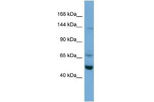 WB Suggested Anti-TRIM66 Antibody Titration:  0. (TRIM66 Antikörper  (N-Term))