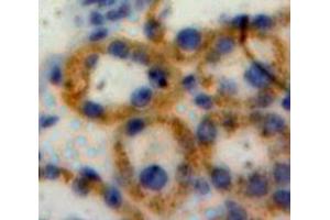 Used in DAB staining on fromalin fixed paraffin-embedded Liver tissue (NOD1 Antikörper  (AA 612-826))