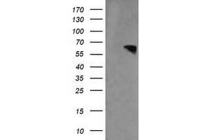 Image no. 1 for anti-Rhotekin (RTKN) antibody (ABIN1500702)
