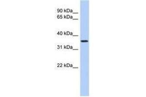 Image no. 1 for anti-Polymerase (RNA) III (DNA Directed) Polypeptide F, 39 KDa (POLR3F) (N-Term) antibody (ABIN6743482) (POLR3F Antikörper  (N-Term))