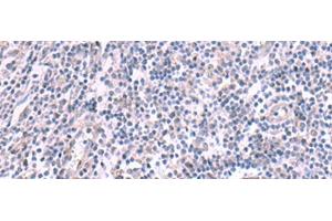 Immunohistochemistry of paraffin-embedded Human tonsil tissue using KCNK10 Polyclonal Antibody at dilution of 1:45(x200) (KCNK10 Antikörper)