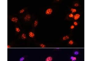 Immunofluorescence analysis of NIH/3T3 cells using TriMethyl-Histone H3-K64 Polyclonal Antibody at dilution of 1:100.