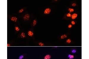 Immunofluorescence analysis of NIH/3T3 cells using TriMethyl-Histone H3-K64 Polyclonal Antibody at dilution of 1:100. (Histone 3 Antikörper  (3meLys64))