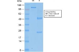 SDS-PAGE Analysis Purified TIMP2 Mouse Recombinant Monoclonal Antibody (rTIMP2/2335). (Rekombinanter TIMP2 Antikörper  (N-Term))