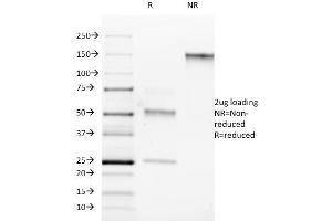 SDS-PAGE Analysis Purified ROR-gamma / RORC Mouse Monoclonal Antibody (RORC/2942). (RORC Antikörper)