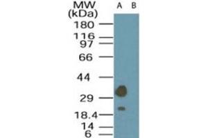 Western blot analysis of LYK5 in A-549 cell lysate in the (A) absence and (B) presence of immunizing peptide using LYK5 polyclonal antibody  at 1 ug/mL . (STRADA Antikörper  (AA 300-350))