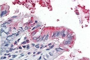 Immunohistochemistry (IHC) image for anti-Glutathione Peroxidase 3 (Plasma) (GPX3) (Internal Region) antibody (ABIN190837)