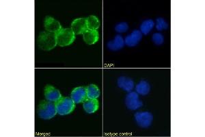 Immunofluorescence staining of Jurkat cells using anti-IL-9R antibody AH9R2. (Rekombinanter IL9 Receptor Antikörper)