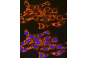 Immunofluorescence analysis of C6 cells using UQCRFS1 Rabbit mAb (ABIN7271127) at dilution of 1:100 (40x lens). (UQCRFS1 Antikörper)