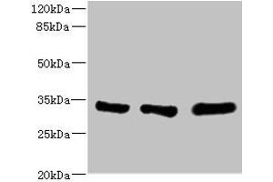 Western blot All lanes: EIF2B1 antibody at 5. (EIF2B1 Antikörper  (AA 1-305))