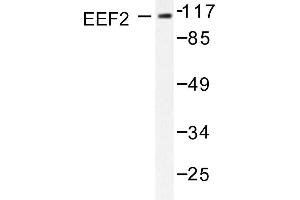 Image no. 1 for anti-Eukaryotic Translation Elongation Factor 2 (EEF2) antibody (ABIN265392) (EEF2 Antikörper)