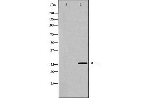 Western blot analysis of extracts of mouse liver, using GSTA1 antibody.