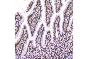 IHC analysis of AHR using anti-AHR antibody (ABIN6719265). (Aryl Hydrocarbon Receptor Antikörper)