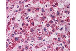 Immunohistochemistry (IHC) image for anti-Anti-MBP-1 (Middle Region) antibody (ABIN311760) (Anti-MBP-1 (Middle Region) Antikörper)