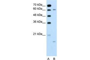 Western Blotting (WB) image for anti-Cytochrome P450, Family 4, Subfamily A, Polypeptide 22 (CYP4A22) antibody (ABIN2462485)