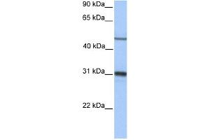 WB Suggested Anti-EPHX1 Antibody Titration: 0. (EPHX1 Antikörper  (Middle Region))